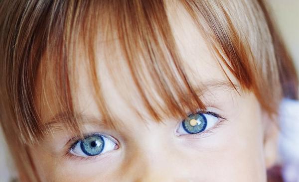 Transitions Optical unterstützt die Kinder-Augen-Krebs-Stiftung