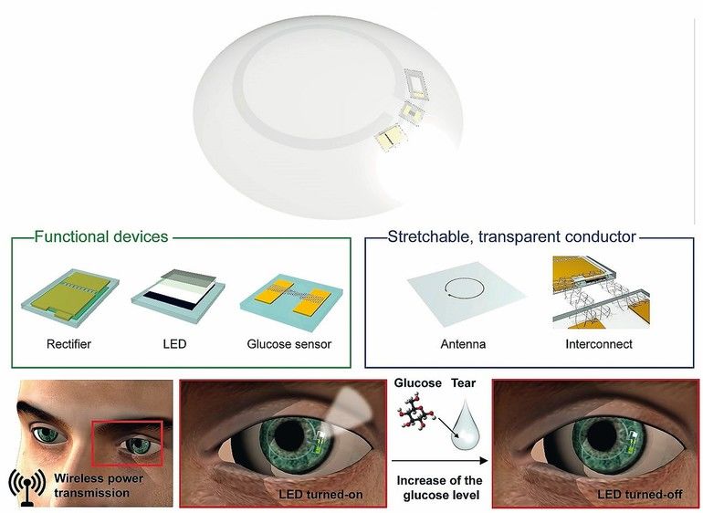 Elektronische Kontaktlinsen