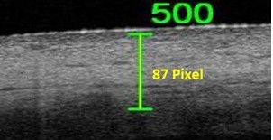 Abbildung1_OCT-Aufnahmen_mit_einer_Strecke_von_500_µm.jpg
